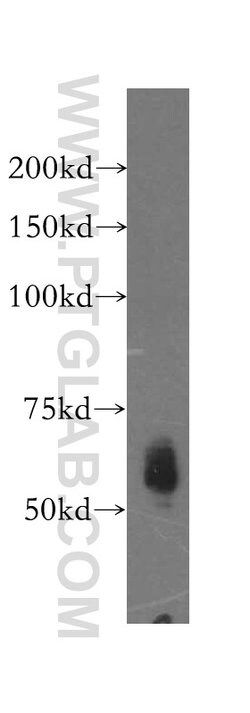 Kininogen 1 Rabbit anti-Human, Polyclonal, Proteintech:Antibodies:Primary
