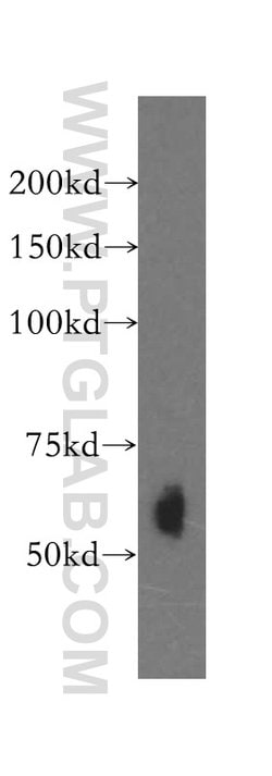 Kininogen 1 Rabbit anti-Human, Polyclonal, Proteintech:Antibodies:Primary