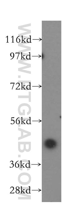 Kininogen 1 Rabbit anti-Human, Polyclonal, Proteintech:Antibodies:Primary