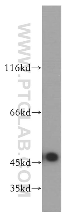 Kininogen 1 Rabbit anti-Human, Polyclonal, Proteintech:Antibodies:Primary