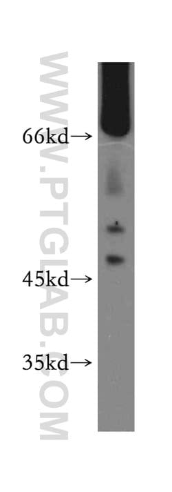 Kininogen 1 Rabbit anti-Human, Polyclonal, Proteintech:Antibodies:Primary