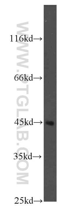 Kininogen 1 Rabbit anti-Human, Polyclonal, Proteintech:Antibodies:Primary