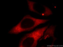 Kininogen 1 Rabbit anti-Human, Polyclonal, Proteintech:Antibodies:Primary