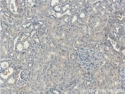 Kininogen 1 Rabbit anti-Human, Polyclonal, Proteintech:Antibodies:Primary