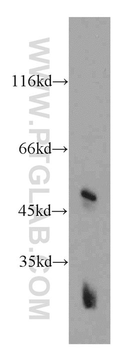 GPR137 Rabbit anti-Human, Mouse, Rat, Polyclonal, Proteintech 150 &mu;L;