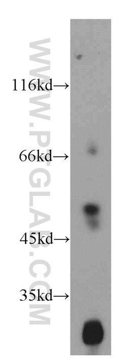 GPR137 Rabbit anti-Human, Mouse, Rat, Polyclonal, Proteintech 150 &mu;L;