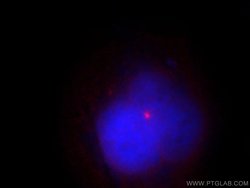 CSPP1 Rabbit anti-Human, Mouse, Rat, Polyclonal, Proteintech 20 &mu;L;