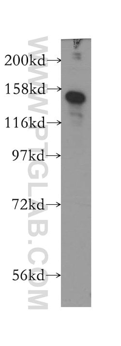 CSPP1 Rabbit anti-Human, Mouse, Rat, Polyclonal, Proteintech 20 &mu;L;