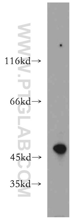 Beta sarcoglycan Rabbit anti-Human, Mouse, Rat, Polyclonal, Proteintech:Antibodies:Primary