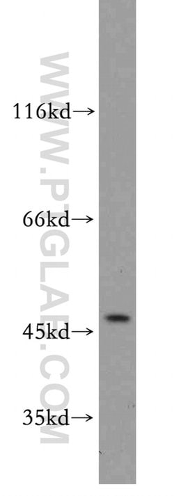 Beta sarcoglycan Rabbit anti-Human, Mouse, Rat, Polyclonal, Proteintech:Antibodies:Primary