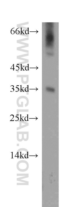 DOK5 Rabbit anti-Human, Mouse, Rat, Polyclonal, Proteintech 150 &mu;L;