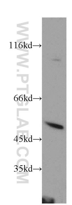 PSTPIP1 Rabbit anti-Human, Mouse, Rat, Polyclonal, Proteintech:Anticorps:Anticorps