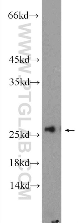 AGR3 Rabbit anti-Human, Mouse, Polyclonal, Proteintech 150 &mu;L; Unconjugated:Antibodies,