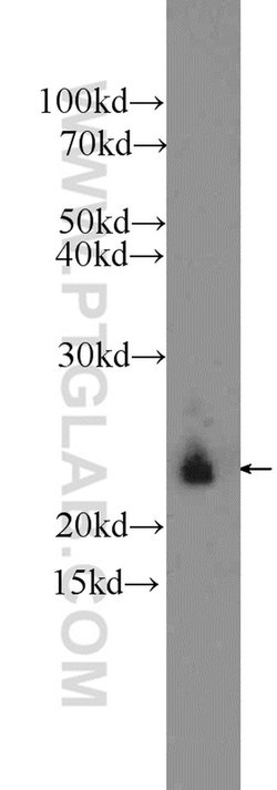 AGR3 Rabbit anti-Human, Mouse, Polyclonal, Proteintech 150 &mu;L; Unconjugated:Antibodies,