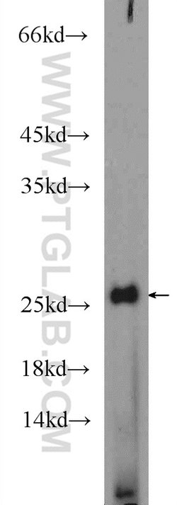 AGR3 Rabbit anti-Human, Mouse, Polyclonal, Proteintech 150 &mu;L; Unconjugated:Antibodies,