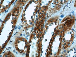 FICD Rabbit anti-Human, Mouse, Rat, Polyclonal, Proteintech 150 &mu;L;