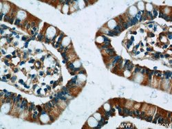 FICD Rabbit anti-Human, Mouse, Rat, Polyclonal, Proteintech 150 &mu;L;