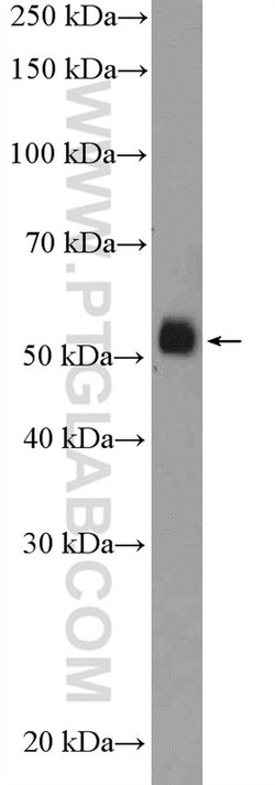 FICD Rabbit anti-Human, Mouse, Rat, Polyclonal, Proteintech 150 &mu;L;