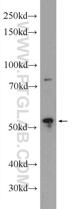 FICD Rabbit anti-Human, Mouse, Rat, Polyclonal, Proteintech 150 &mu;L;