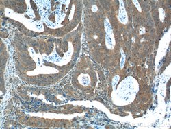 FANCA Rabbit anti-Human, Polyclonal, Proteintech 150 &mu;L; Unconjugated:Antibodies,