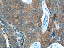 FANCA Rabbit anti-Human, Polyclonal, Proteintech 150 &mu;L; Unconjugated:Antibodies,