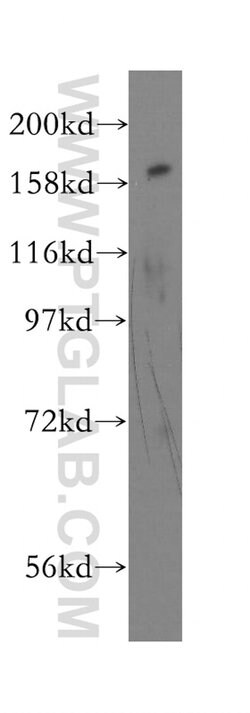FANCA Rabbit anti-Human, Polyclonal, Proteintech 150 &mu;L; Unconjugated:Antibodies,