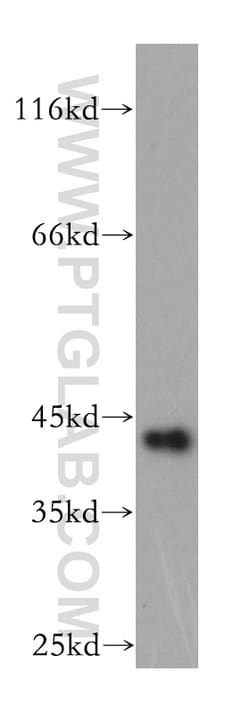 GDAP1L1 Rabbit anti-Human, Mouse, Polyclonal, Proteintech 150 &mu;L; Unconjugated:Antibodies,