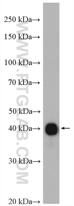GDAP1L1 Rabbit anti-Human, Mouse, Polyclonal, Proteintech 150 &mu;L; Unconjugated:Antibodies,