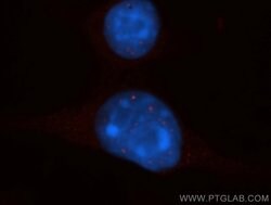 EXOSC8 Rabbit anti-Human, Mouse, Rat, Polyclonal, Proteintech:Antibodies:Primary