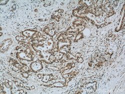 EXOSC8 Rabbit anti-Human, Mouse, Rat, Polyclonal, Proteintech:Antibodies:Primary