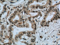 EXOSC8 Rabbit anti-Human, Mouse, Rat, Polyclonal, Proteintech:Antibodies:Primary