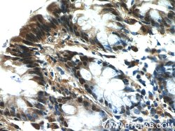EXOSC8 Rabbit anti-Human, Mouse, Rat, Polyclonal, Proteintech:Antibodies:Primary