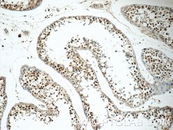 EXOSC8 Rabbit anti-Human, Mouse, Rat, Polyclonal, Proteintech:Antibodies:Primary