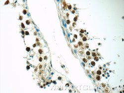EXOSC8 Rabbit anti-Human, Mouse, Rat, Polyclonal, Proteintech:Antibodies:Primary
