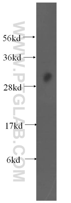 EXOSC8 Rabbit anti-Human, Mouse, Rat, Polyclonal, Proteintech:Antibodies:Primary