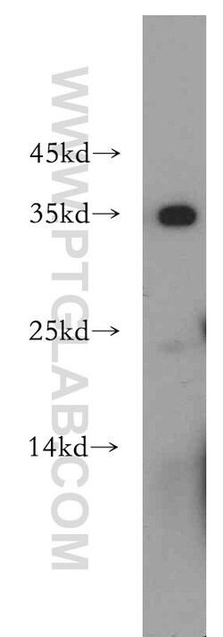 EXOSC8 Rabbit anti-Human, Mouse, Rat, Polyclonal, Proteintech:Antibodies:Primary