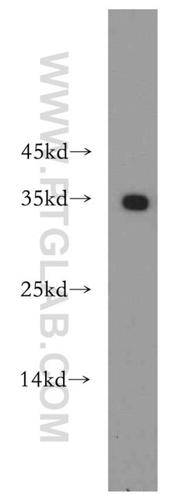 EXOSC8 Rabbit anti-Human, Mouse, Rat, Polyclonal, Proteintech:Antibodies:Primary