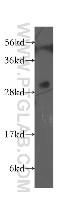 EXOSC8 Rabbit anti-Human, Mouse, Rat, Polyclonal, Proteintech:Antibodies:Primary