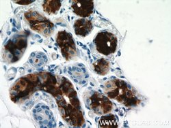 DCD Rabbit anti-Human, Polyclonal, Proteintech:Antibodies:Primary Antibodies