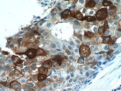 DCD Rabbit anti-Human, Polyclonal, Proteintech:Antibodies:Primary Antibodies