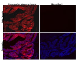 Invitrogen beta Catenin Monoclonal Antibody (15B8), PE, eBioscience , Invitrogen