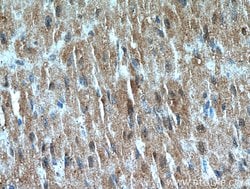 VPS45 Rabbit anti-Human, Mouse, Rat, Polyclonal, Proteintech 20 &mu;L;