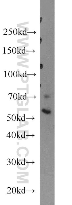 ERO1L Rabbit anti-Human, Mouse, Rat, Polyclonal, Proteintech:Antibodies:Primary
