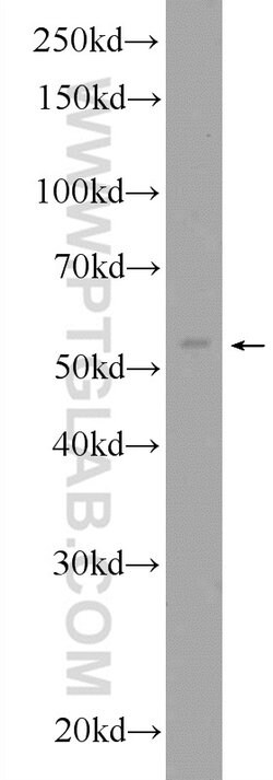 ERO1L Rabbit anti-Human, Mouse, Rat, Polyclonal, Proteintech:Antibodies:Primary