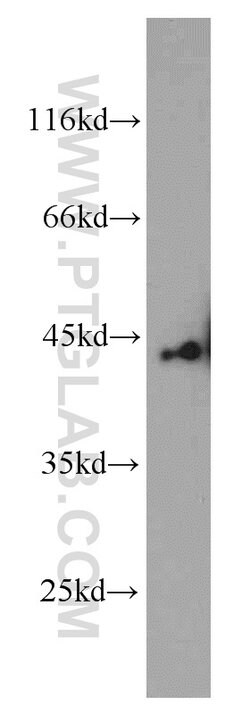 SMYD3 Rabbit anti-Human, Mouse, Rat, Polyclonal, Proteintech:Antibodies:Primary