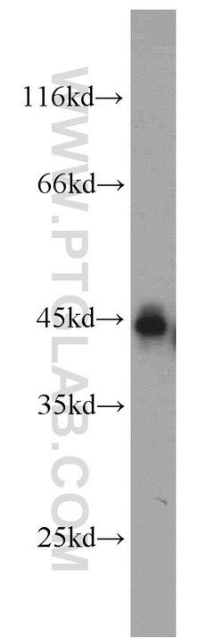 SMYD3 Rabbit anti-Human, Mouse, Rat, Polyclonal, Proteintech:Antibodies:Primary