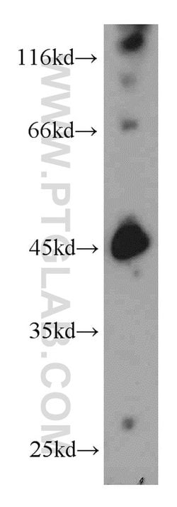 SMYD3 Rabbit anti-Human, Mouse, Rat, Polyclonal, Proteintech:Antibodies:Primary
