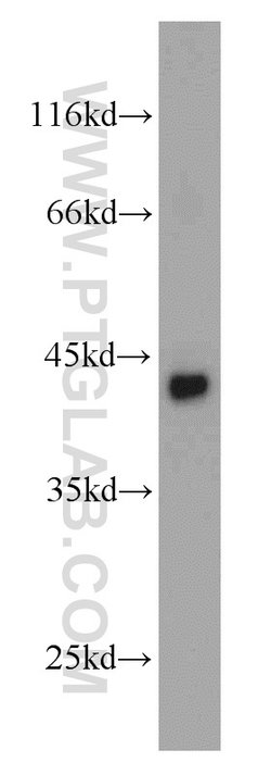 SMYD3 Rabbit anti-Human, Mouse, Rat, Polyclonal, Proteintech:Antibodies:Primary