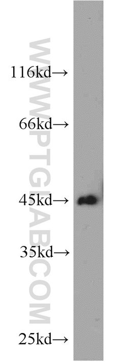 SMYD3 Rabbit anti-Human, Mouse, Rat, Polyclonal, Proteintech:Antibodies:Primary
