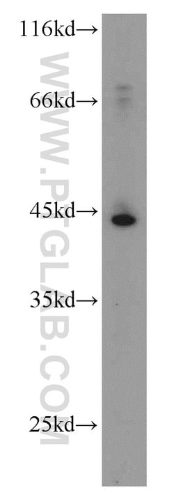 SMYD3 Rabbit anti-Human, Mouse, Rat, Polyclonal, Proteintech:Antibodies:Primary